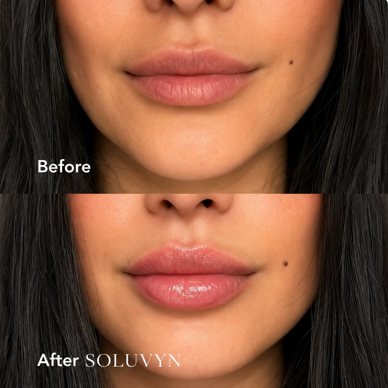 Hyaluronic Acid Lip Plumper